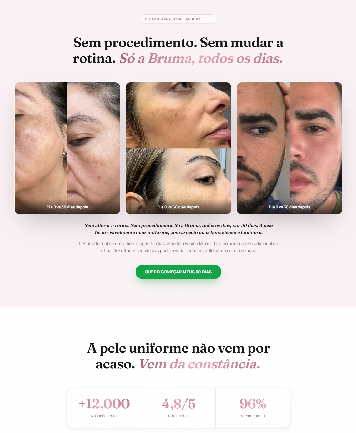 Lagai Bruma - Sem procedimento, sem mudar a rotina